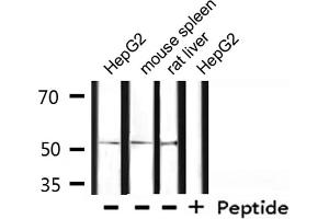Western blot analysis of extracts from HepG2, mouse spleen, rat liver , using OCT2 Antibody. (Oct-2 Antikörper)