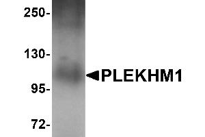 Western Blotting (WB) image for anti-Pleckstrin Homology Domain Containing, Family M (With RUN Domain) Member 1 (PLEKHM1) (N-Term) antibody (ABIN1031519) (PLEKHM1 Antikörper  (N-Term))
