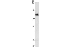 Western Blotting (WB) image for anti-Adenosine Monophosphate Deaminase 1 (AMPD1) antibody (ABIN2432475) (AMPD1 Antikörper)