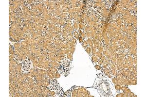 ABIN7094454 and ABIN7098502 at 1/100 staining Mouse kidney tissue by IHC-P.
