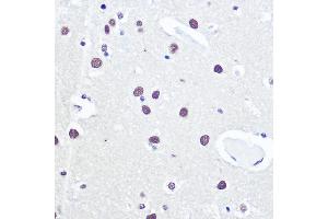 Immunohistochemistry of paraffin-embedded human brain using 53BP1 Rabbit pAb (ABIN6128833, ABIN6149414, ABIN6149415 and ABIN6221431) at dilution of 1:100 (40x lens). (TP53BP1 Antikörper  (AA 1763-1977))