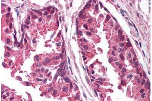 Human Prostate (formalin-fixed, paraffin-embedded) stained with TICAM1 antibody ABIN213993 at 5 ug/ml followed by biotinylated goat anti-rabbit IgG secondary antibody ABIN481713, alkaline phosphatase-streptavidin and chromogen. (TICAM1 Antikörper  (C-Term))