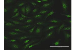 Immunofluorescence (IF) image for anti-Nuclear Receptor Subfamily 0, Group B, Member 1 (NR0B1) (AA 1-470) antibody (ABIN513187)