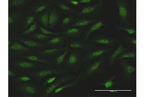 Immunofluorescence of purified MaxPab antibody to NR0B1 on HeLa cell.