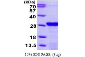 SDS-PAGE (SDS) image for PDGFA Associated Protein 1 (PDAP1) (AA 1-181) protein (His tag) (ABIN667807) (PDAP1 Protein (AA 1-181) (His tag))