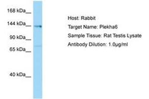 Image no. 1 for anti-Pleckstrin Homology Domain Containing, Family A Member 6 (PLEKHA6) (AA 176-225) antibody (ABIN6749876) (PLEKHA6 Antikörper  (AA 176-225))