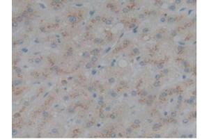 Detection of SELL in Human Liver Tissue using Polyclonal Antibody to Selectin, Leukocyte (SELL) (L-Selectin Antikörper  (AA 109-346))