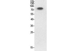 Western Blotting (WB) image for anti-Ubiquitin (Ub) (acLys33) antibody (ABIN3181498)