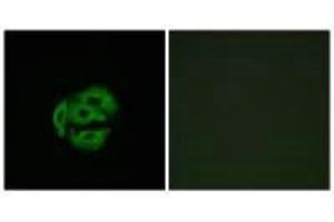 Immunofluorescence analysis of A549 cells, using Cytochrome P450 39A1 antibody. (CYP39A1 Antikörper)