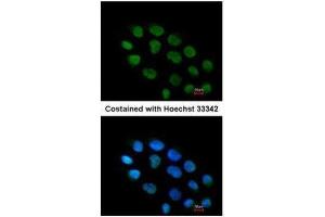 ICC/IF Image Immunofluorescence analysis of paraformaldehyde-fixed A431, using ZNF7, antibody at 1:200 dilution. (ZNF7 Antikörper)