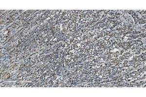 IHC analysis of Transketolase/TKT using anti-Transketolase/TKT antibody (ABIN7598958). (TKT Antikörper  (AA 1-116))