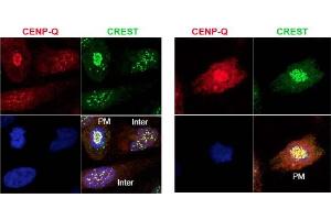 Image no. 1 for anti-Centromere Protein Q (CENPQ) antibody (ABIN401060) (CENPQ Antikörper)