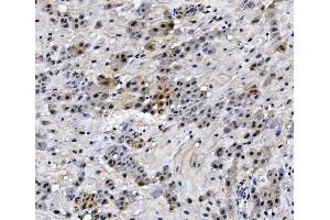 IHC analysis of HMGB3 using anti-HMGB3 antibody (ABIN7603126). (HMGB3 Antikörper  (N-Term))