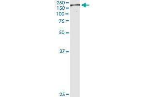 Immunoprecipitation of NUMA1 transfected lysate using anti-NUMA1 monoclonal antibody and Protein A Magnetic Bead , and immunoblotted with NUMA1 MaxPab rabbit polyclonal antibody. (NUMA1 Antikörper  (AA 200-306))