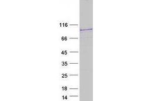 STRN4 Protein (Transcript Variant 2) (Myc-DYKDDDDK Tag)