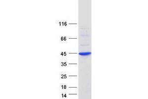 Western Blotting (WB) image for Regulator of Calcineurin 1 (RCAN1) (Transcript Variant 1) protein (Myc-DYKDDDDK Tag) (ABIN2713037)