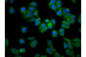 Immunofluorescence staining of HepG2 cells with ABIN7167248 at 1:133, counter-stained with DAPI. (RAB21 Antikörper  (AA 141-222))