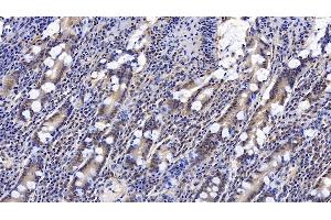Detection of CNX in Human Small intestine Tissue using Monoclonal Antibody to Calnexin (CNX) (Calnexin Antikörper  (AA 239-461))