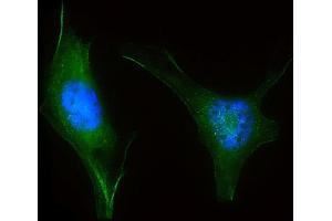 Immunofluorescent analysis of 4 % paraformaldehyde-fixed, 0. (LZIC Antikörper  (AA 81-109))