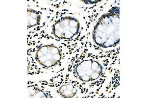 Immunohistochemistry (Paraffin-embedded Sections) (IHC (p)) image for anti-Ring Finger Protein 7 (RNF7) antibody (ABIN7075471)