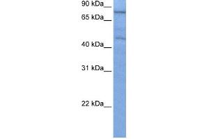 WB Suggested Anti-ZNF555 Antibody Titration:  0. (ZNF555 Antikörper  (C-Term))