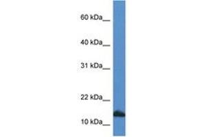 Image no. 1 for anti-Cytidine Deaminase (CDA) (C-Term) antibody (ABIN6746945) (CDA Antikörper  (C-Term))