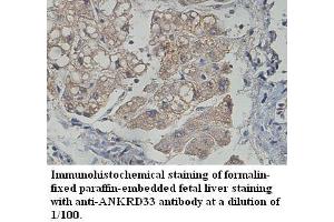 Image no. 1 for anti-Ankyrin Repeat Domain 33 (ANKRD33) antibody (ABIN1574705) (ANKRD33 Antikörper)