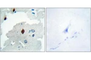 Immunohistochemistry analysis of paraffin-embedded human brain tissue, using PTTG Antibody. (PTTG1 Antikörper  (AA 116-165))