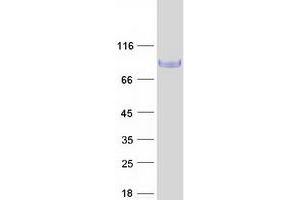 Validation with Western Blot