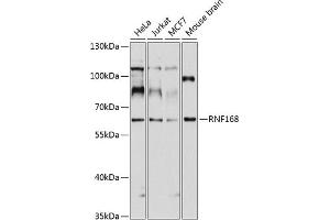 Western blot analysis of extracts of various cell lines, using RNF168 antibody (ABIN1682548, ABIN3017831, ABIN3017832 and ABIN6220281) at 1:1000 dilution. (RNF168 Antikörper  (AA 300-571))