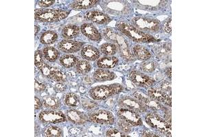 Immunohistochemical staining of human kidney with TMLHE polyclonal antibody  shows strong cytoplasmic positivity in cells in tubules. (TMLHE Antikörper)