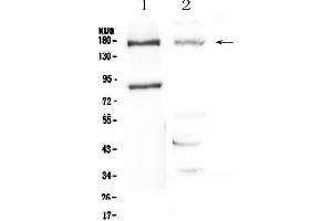 Western blot analysis of Niemann Pick C1 using anti-Niemann Pick C1 antibody .