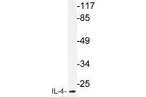 Western blot analysis of IL-4 antibody in extracts from MCF-7cells. (IL-4 Antikörper)