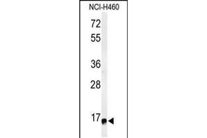 Western blot analysis of RPS13 Antibody in NCI-H460 cell line lysates (35ug/lane) (RPS13 Antikörper  (AA 82-110))