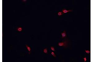 ABIN6268843 staining HeLa cells by IF/ICC. (NOTCH2 Antikörper)
