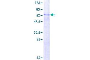 Image no. 1 for delta-Like 1 Homolog (Drosophila) (DLK1) (AA 25-383) protein (GST tag) (ABIN1351681)