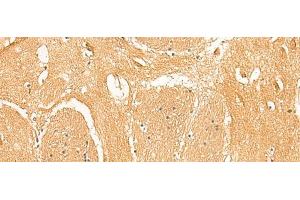 Immunohistochemistry of paraffin-embedded Human brain tissue using PPP1R1A Polyclonal Antibody at dilution of 1:50(x200) (PPP1R1A Antikörper)