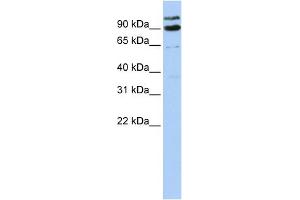 WB Suggested Anti-LONRF3 Antibody Titration:  0. (LONRF3 Antikörper  (Middle Region))
