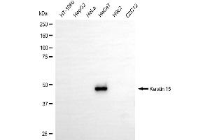 Western blotting analysis using keratin 15 antibody (ABIN7799170).