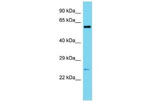 Western Blotting (WB) image for anti-Sperm Associated Antigen 7 (SPAG7) (N-Term) antibody (ABIN2790586) (SPAG7 Antikörper  (N-Term))