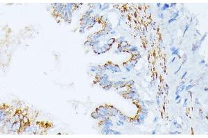 Immunohistochemistry of paraffin-embedded Rat lung using IL3RA Polyclonal Antibody at dilution of 1:100 (40x lens).