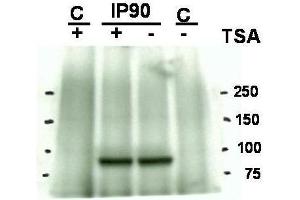 Western blot using  Affinity Purified anti-Hsp90 acetyl K294 antibody shows detection of a band at ~90 kDa corresponding to Hsp90 in an SkBr3 cell lysate (arrowhead) after treatment with Trichostatin A (an HDAC inhibitor). (HSP90 Antikörper  (Lys294))