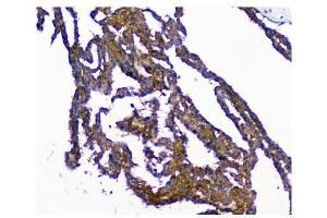 IHC analysis of NMI using anti-NMI antibody (ABIN3043451). (NMI Antikörper  (AA 2-307))