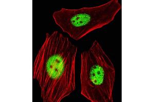 Fluorescent image of HeLa cells stained with AG Antibody (C-term) (ABIN1944739 and ABIN2838563). (AGAP4 Antikörper  (C-Term))