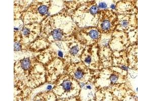 Immunohistochemistry (IHC) image for anti-V-Akt Murine Thymoma Viral Oncogene Homolog 1 (AKT1) (N-Term) antibody (ABIN1031225) (AKT1 Antikörper  (N-Term))