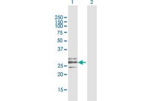 Western Blotting (WB) image for anti-C-Type Lectin Domain Family 9, Member A (CLEC9A) (AA 1-241) antibody (ABIN950110)