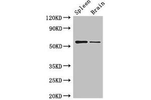 Western Blot Positive WB detected in: Mouse spleen tissue, Mouse brain tissue All lanes: D2HGDH antibody at 3 μg/mL Secondary Goat polyclonal to rabbit IgG at 1/50000 dilution Predicted band size: 57, 33, 35 kDa Observed band size: 57 kDa (D2HGDH Antikörper  (AA 14-521))