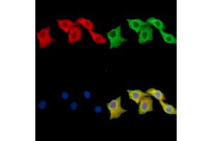 ABIN7095992 and ABIN7100054 staining Hela cells by IF/ICC. (SNAP47 Antikörper)
