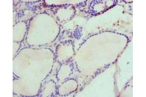 Immunohistochemistry of paraffin-embedded human thyroid tissue using ABIN7155960 at dilution of 1:100 (HAS3 Antikörper  (AA 339-553))