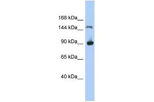 WB Suggested Anti-MGC50722 Antibody Titration: 0. (MGC50722 Antikörper  (N-Term))